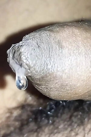 Tight Foreskin Phimosis Dick Closeup Dripping Precum Until Cum