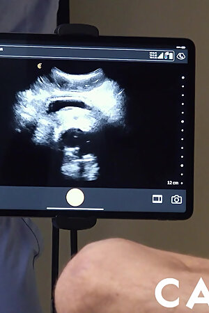 FunSizeBoys - Dr. Legrand Wolf and nurse breed tiny ultrasound bottom