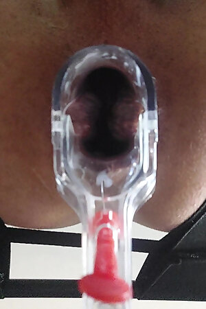 Her ass is really very greedy greedy dilatation anal butt plug speculum insertion big dildo huge deep insertion