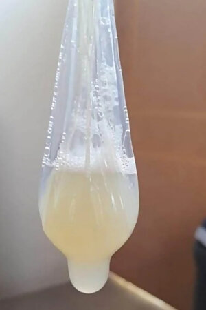 Condom Filled Up Sperm Load Jizz Condom Cumshot