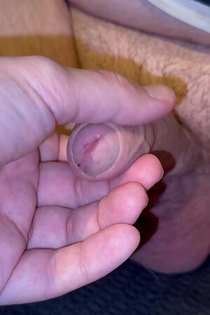 Jerkbuddy plays with my foreskin until i get hard