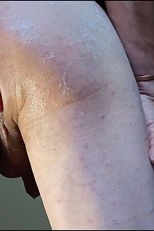 anal enlargement attempt